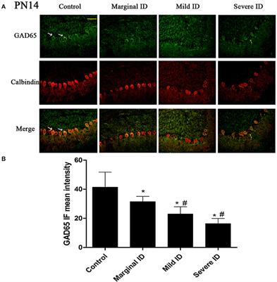 Maternal Different Degrees of Iodine Deficiency during Pregnant and Lactation Impair the Development of Cerebellar Pinceau in Offspring